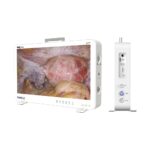 Camjoy CK927 27 Zoll 4K UHD All-in-One Portable Endoskop Kamera