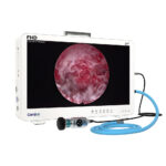 CF924 24Zoll tragbare Endoskopkamera