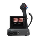 Digitales Gastroskop mit All-in-One-Prozessor