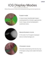 Camjoy CK701 4K ICG Dual 4K Fluoreszenzendoskop-Kameraturmsystem – Bild 6