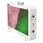 Camjoy CG932 32 Zoll 4K-ICG FPGA Endoskop-Kamerasystem 02