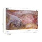Camjoy CK927 27 4K Ultra HD Endoskop-Kamerasystem Surgical Clarity 4K 03