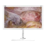 Camjoy CF0 32-inch white FHD surgical monitor perspective view